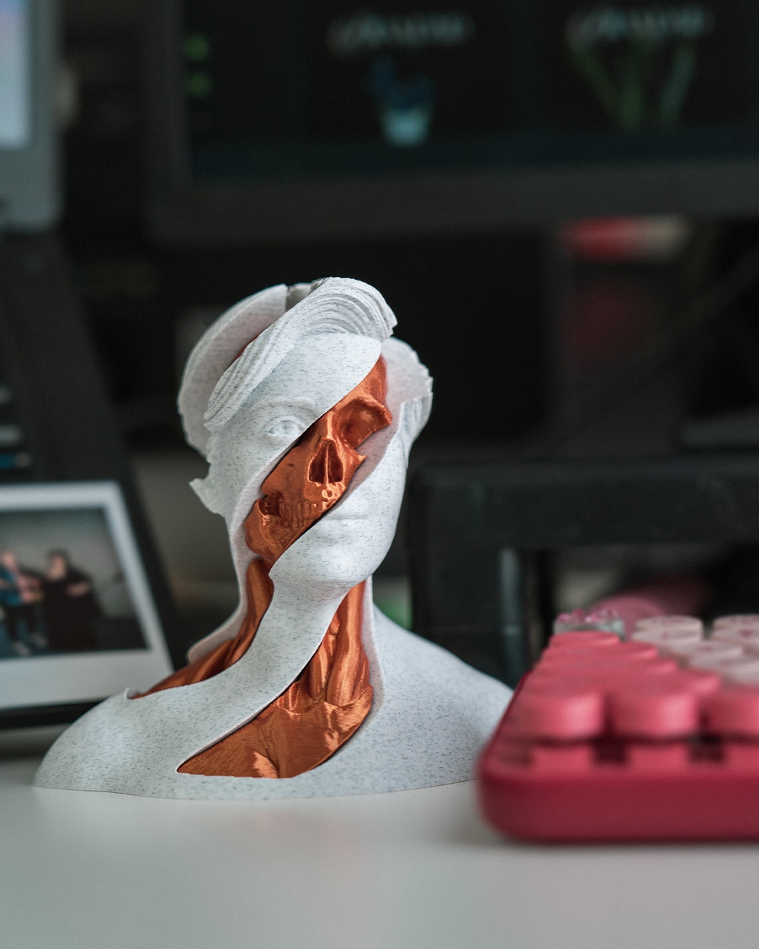 Whirls Anatomy - Image 2